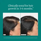 Nutrafol Women Hair Growth Nutraceuticals Dietary Supplement 120 Capsules